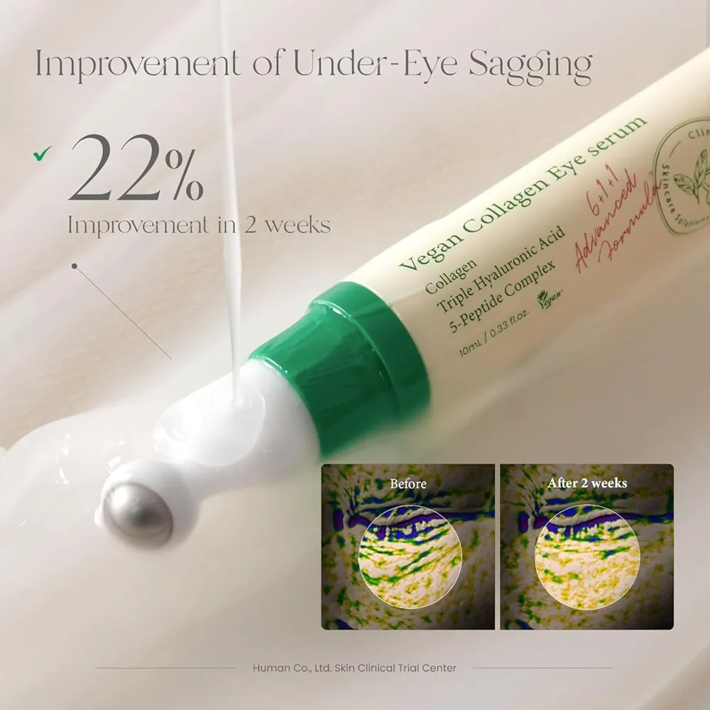 درباره خرید دور چشم اکسیس وای اصل + بهترین قیمت (کاهش چین و چروک)